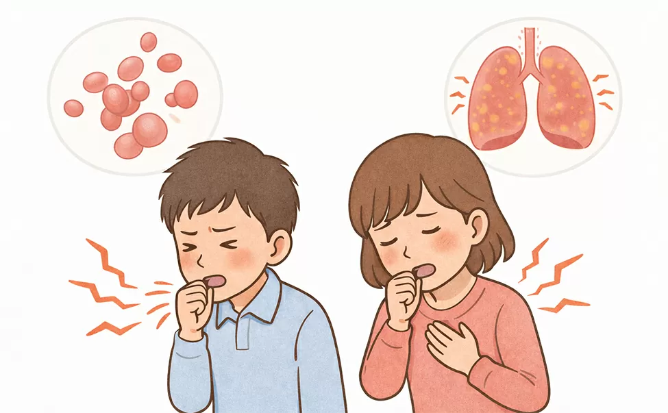 マイコプラズマ肺炎